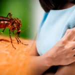 alivia-la-picazon-por-mosquitos-con-estos-remedios-caseros